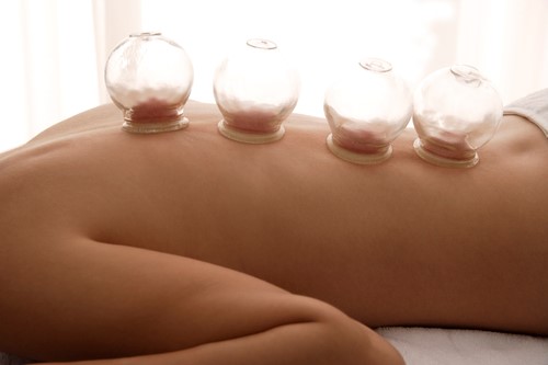cupping, acupuncture, monument co 80132, monument chiropractor